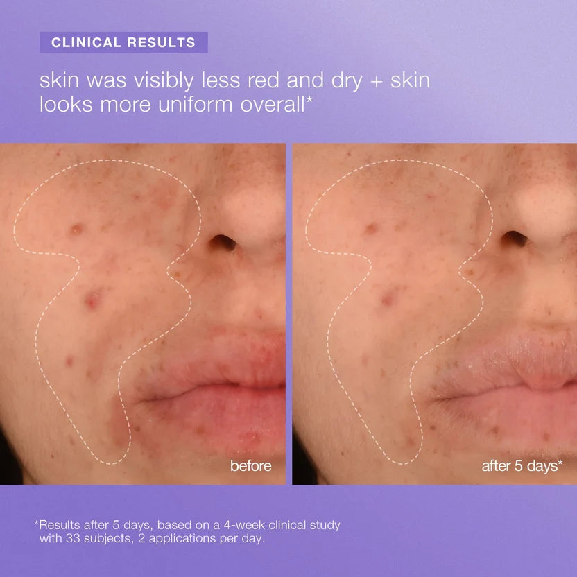 Stabilizing Repair Face & Body Serum