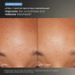 Discover Healthy Skin Kit