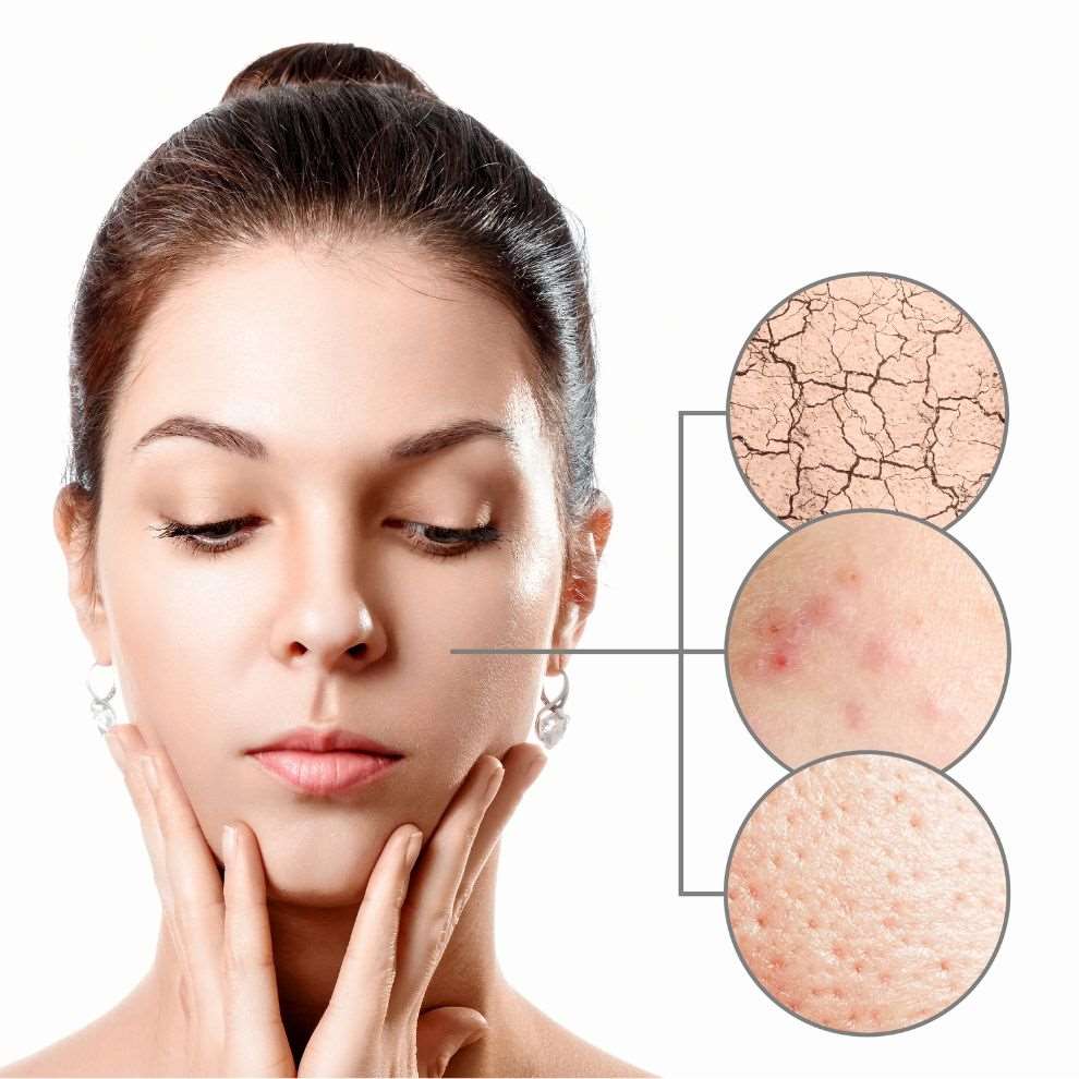 Pico Pore Laser Treatment The Quinn Sdn.Bhd